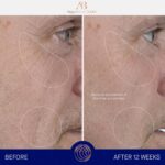 Augustinus Bader The Serum – Luxury Hydrating Anti-Aging Face Serum – Boosts Firmness, Smooths Fine Lines & Evens Skin Tone - Image 4