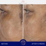 Augustinus Bader The Serum – Luxury Hydrating Anti-Aging Face Serum – Boosts Firmness, Smooths Fine Lines & Evens Skin Tone – Lightweight, Fast-Absorbing Formula – 30 ml / 1 fl oz - Image 6