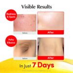 EQQUALBERRY Vitamin Illuminating Serum | Niacinamide 4% & TXA | Brightening Vitamin C Serum for Face Glow with Hyaluronic Acid | Dark Spot & Uneven Tone Care | Korean Skincare, 1.01 fl oz - Image 5