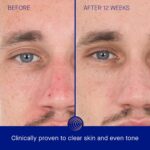 Augustinus Bader The Retinol Serum – Luxury Anti-Aging Face Serum – Smooths Fine Lines, Boosts Firmness & Radiance – Hydrating, Restorative & Skin-Friendly Formula - Image 4