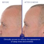 Augustinus Bader The Retinol Serum – Luxury Anti-Aging Face Serum – Smooths Fine Lines, Boosts Firmness & Radiance – Hydrating, Restorative & Skin-Friendly Formula - Image 5