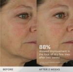 TATCHA The Dewy Skin Cream | Rich Face Cream to Hydrate, Plump and Protect Dry and Combo Skin, - Image 8