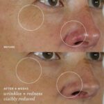 Tatcha The Silk Serum Wrinkle-Smoothing Retinol Alternative | 30 ml / 1 oz - Image 5