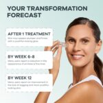 Seranova Micro Infusion System for Face & Neck 0.05mm Stamp with Hyaluronic Acid & Collagen Peptide Serum for Firmer Smoother-Looking Skin, Easy 5-Minute At-Home Skin Care Application - 3 Month Supply - Image 4