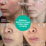 TruSkin Face Serum Duo - Vitamin C Serum & Retinol Serum for Face - AM & PM Anti Aging Skincare Routine - Brightening & Smoothing Facial Serums, 1 fl oz Each - Image 5