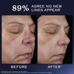Lancôme Génifique Ultimate Dual Recovery Face Serum- Anti-Aging Serum Visibly Improves Fine Lines, Rough Texture, Plumpness and Even Skintone - with Beta Glucan and, Hyaluronic Acid - Image 4