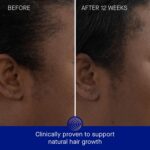 Augustinus Bader Women's The Scalp Treatment - Image 3