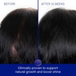 Augustinus Bader Women's The Scalp Treatment - Image 4