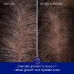 Augustinus Bader Women's The Scalp Treatment - Image 7