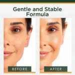 Tree of Life Vitamin C Serum For Face - Brightening Face Oil for Dark & Age Spots - For Dry & Sensitive Skin with Vitamin E for Soft Smooth Glow - Dermatologist Tested, 1 Fl Oz - Image 4