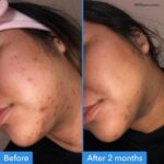 Good Molecules Discoloration Correcting Serum - Serum to Target Dark Spots and Discoloration - Skin Care for Face, 1 fl oz - Image 4