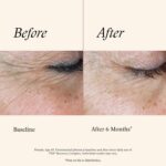 SkinMedica TNS Recovery Complex Facial Treatment - Advanced Growth Factor & Exosome Formula for Skin Rejuvenation - Helps to Improve the Appearance of Fine Lines, Wrinkles, and Uneven Skin Tone (1 Oz) - Image 5