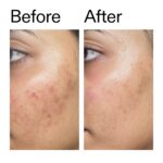 The INKEY List Ectoin Hydro-Barrier Serum, Advanced Dual-Action Serum, Boosts Hydration, Builds Stronger Skin Barrier, Lightweight Texture - Image 8