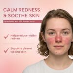 suquato 10% Azelaic Acid Cream – Rosacea Treatment for Face & Redness Reducing Face Cream – Redness & Blemish Care for Sensitive Skin – Lightweight Daily Use 30g - Image 3
