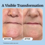 Vibriance Super C Serum for Mature Skin - All-in-One Vitamin Formula Hydrates, Firms, Lifts, Smooths, Targets Age Spots, Wrinkles, 1 fl oz - Image 6