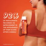Bio-Oil Skincare Body Oil Serum, Scars & Stretch Marks, 2 fl oz | Dermatologist Recommended, Vitamin E & A, Dry & Sensitive Skin, Non-Comedogenic, Face and Body, Scar Treatment - Image 4