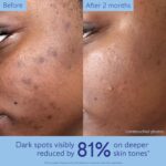 Caudalie Vinoperfect Brightening Dark Spot Serum Vitamin C Alternative - Image 5