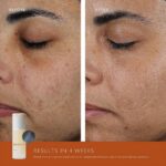 Omorovicza Elixir Serum (1.0 oz), Instant Face Lift Serum with 4x Healing Concentrate, Sage & Pumpkin Seed Extracts to Hydrate, Firm, Brighten & Strengthen Skin, Radiance Booster - Image 6