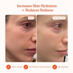 Tower 28 SOS Recovery Hydrating Face Cream for Sensitive Skin (1.86 oz) | Skin Barrier Repair Face Moisturizer with Hyaluronic Acid & Ceramides, Helps Reduce Redness & Skin Texture, Non-Comedogenic - Image 3